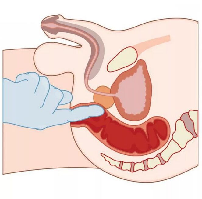 Mannelijke G-spot locatie